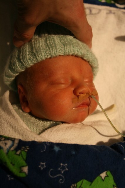 In NICU